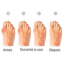 Meia Ortopédica - Corretor de Joanete (COMPRE 1 LEVE 2)