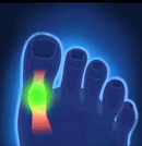 Meia Ortopédica - Corretor de Joanete (COMPRE 1 LEVE 2)